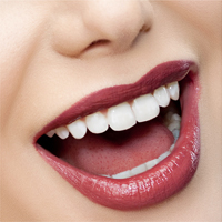 Tooth Colored Fillings: Now You See ’em…