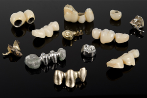 Crowns: Dental Workhorses