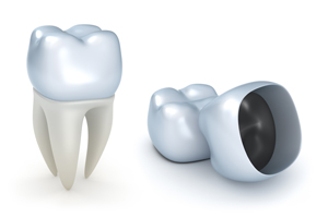 Crown Considerations