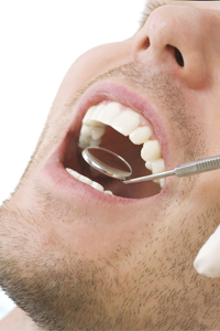 On Guard Against Oral Cancer