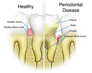 Healthy Gums, Healthy You!