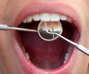 Trouble Spots & Oral Lesions