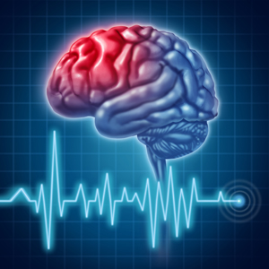 Stroke Prevention: Routine Dental Hygiene Appointments