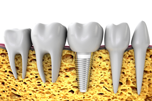 When Prescriptions and Dentistry Don’t Mix