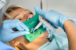 The Rubber Dental Dam
