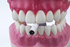 What You and Your Mouth Need to Know About Cancer