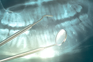 X-Rays From Our Perspective