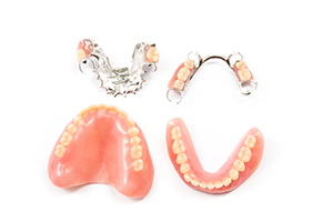 When a Tooth Goes Missing
