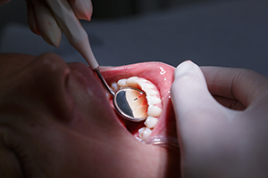 Your Mouth Says A Lot at Your Checkup