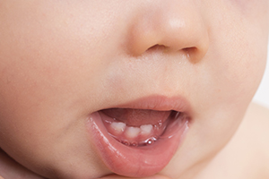 Preventing Cavities in Your Baby’s Teeth