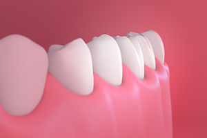 The Long & Short of Gum Disease