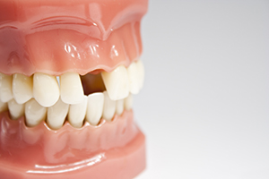 Uh-oh! A Dental Emergency
