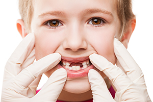 Kids Can Get Gum Disease Too