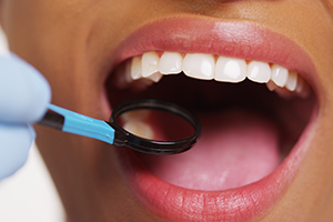 Checkups For Your Smile!