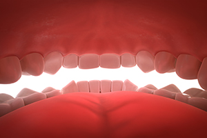 Other Oral Concerns… Besides Teeth